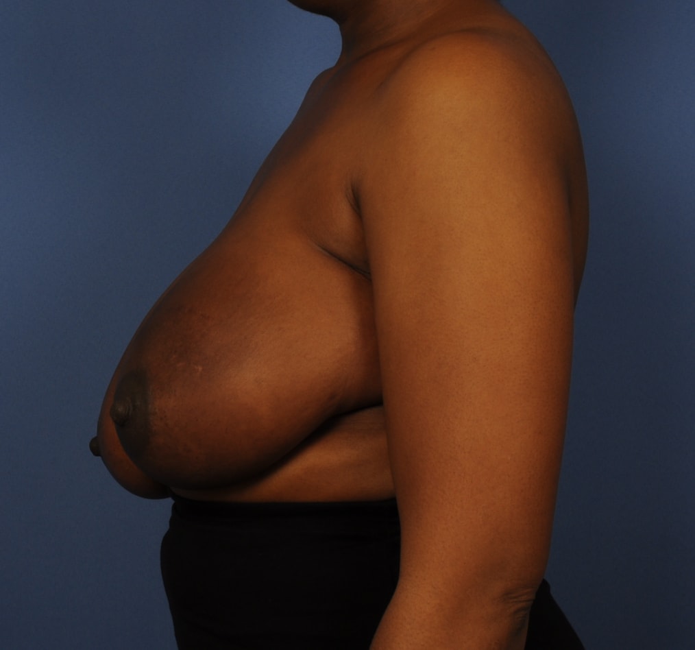 Patient 102 gallery before d