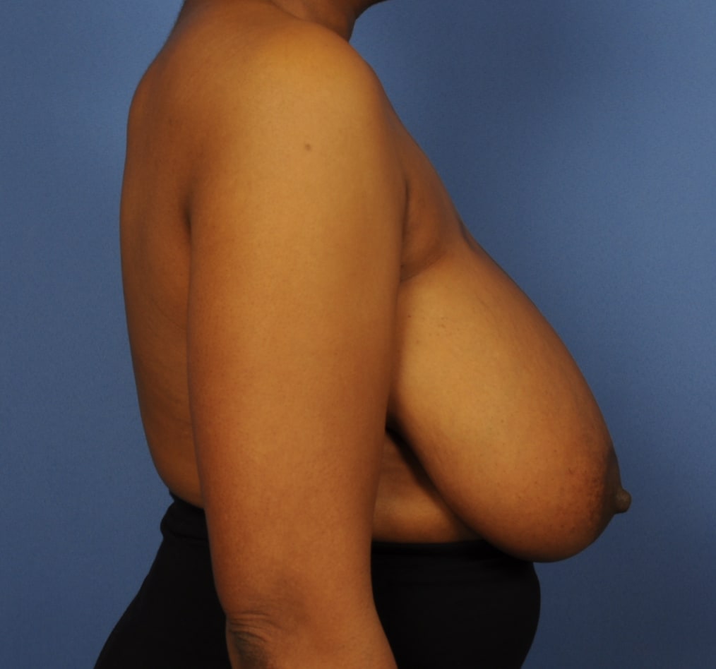 Patient 102 gallery before e