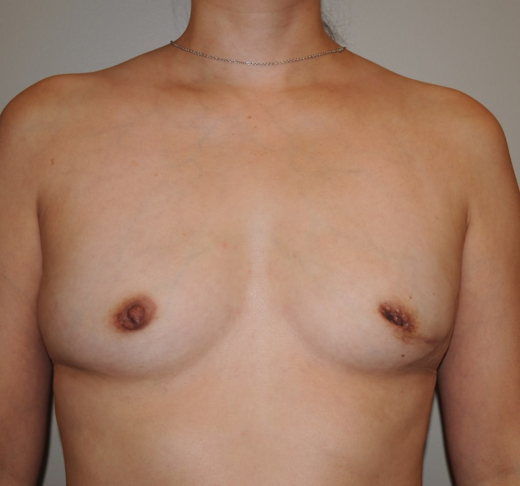 Patient 103 gallery before a