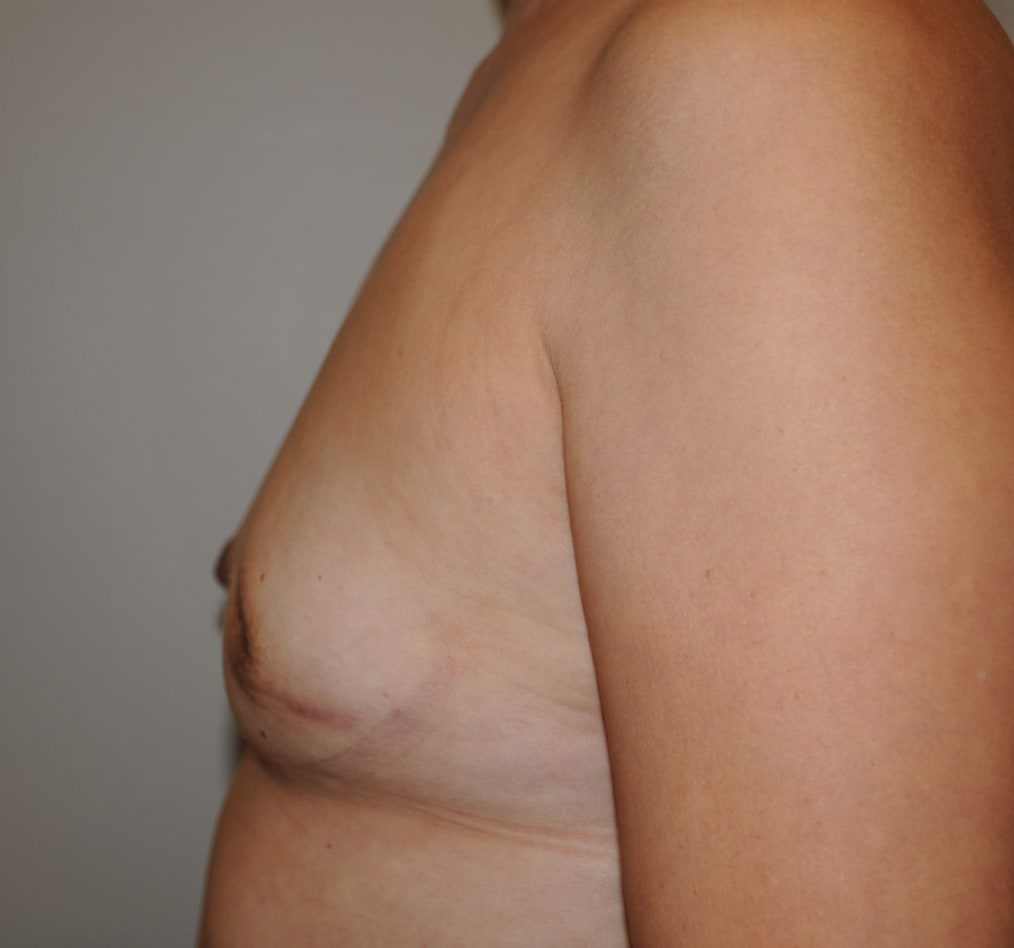 Patient 103 gallery before d