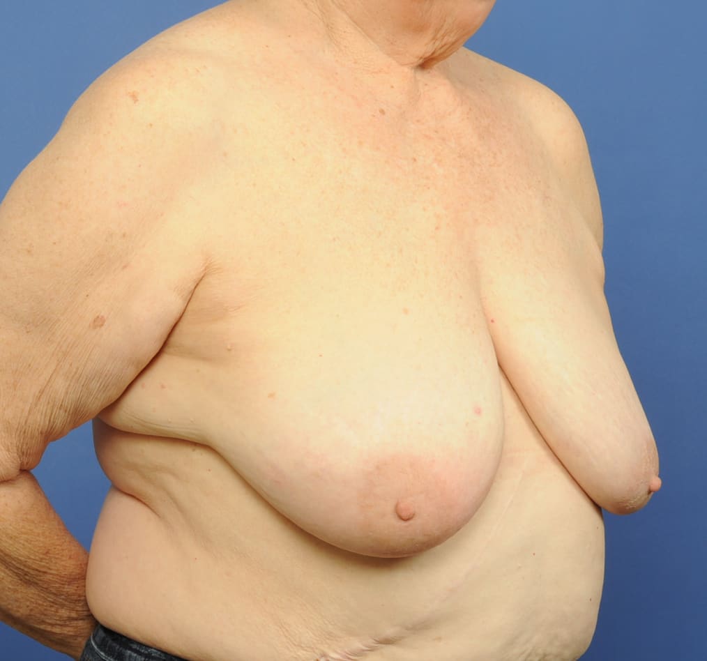 Patient 88 gallery before c