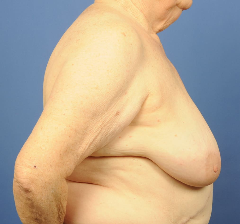 Patient 88 gallery before e