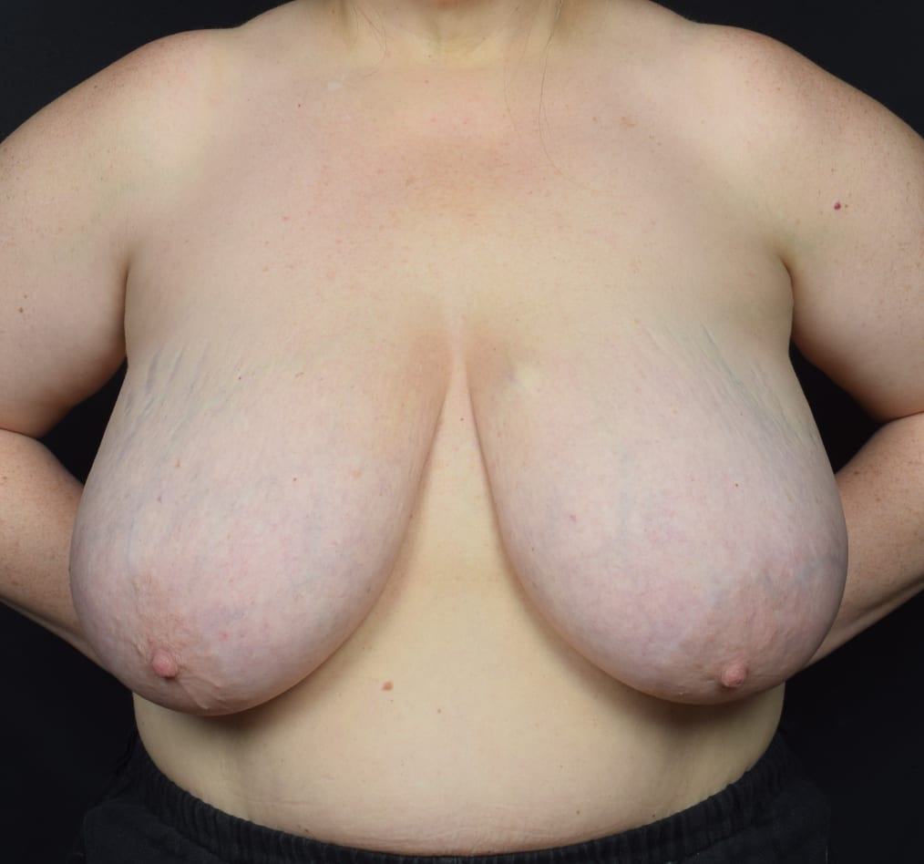 Patient 89 gallery before a