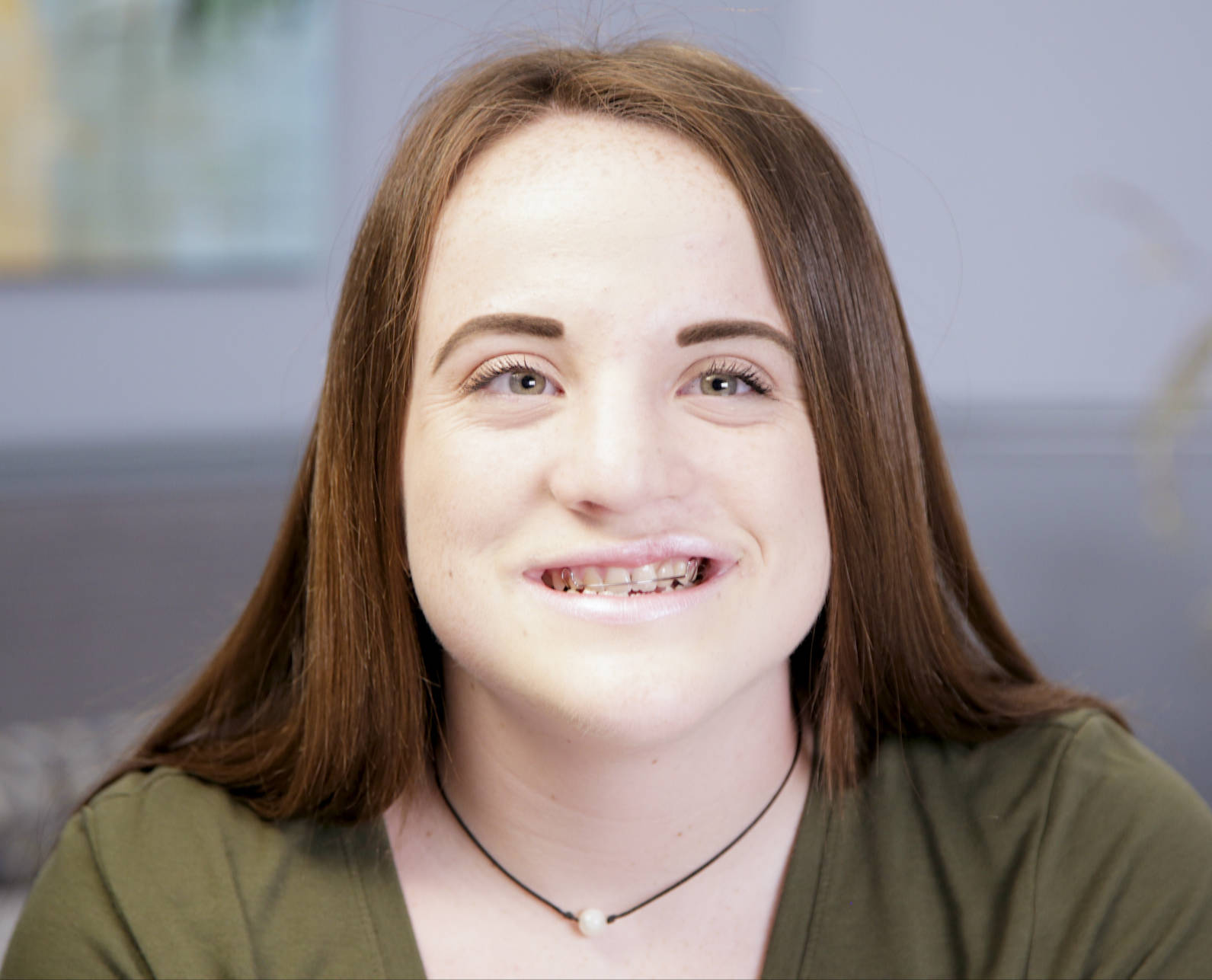 Nicole testimonial oral pathology facewall