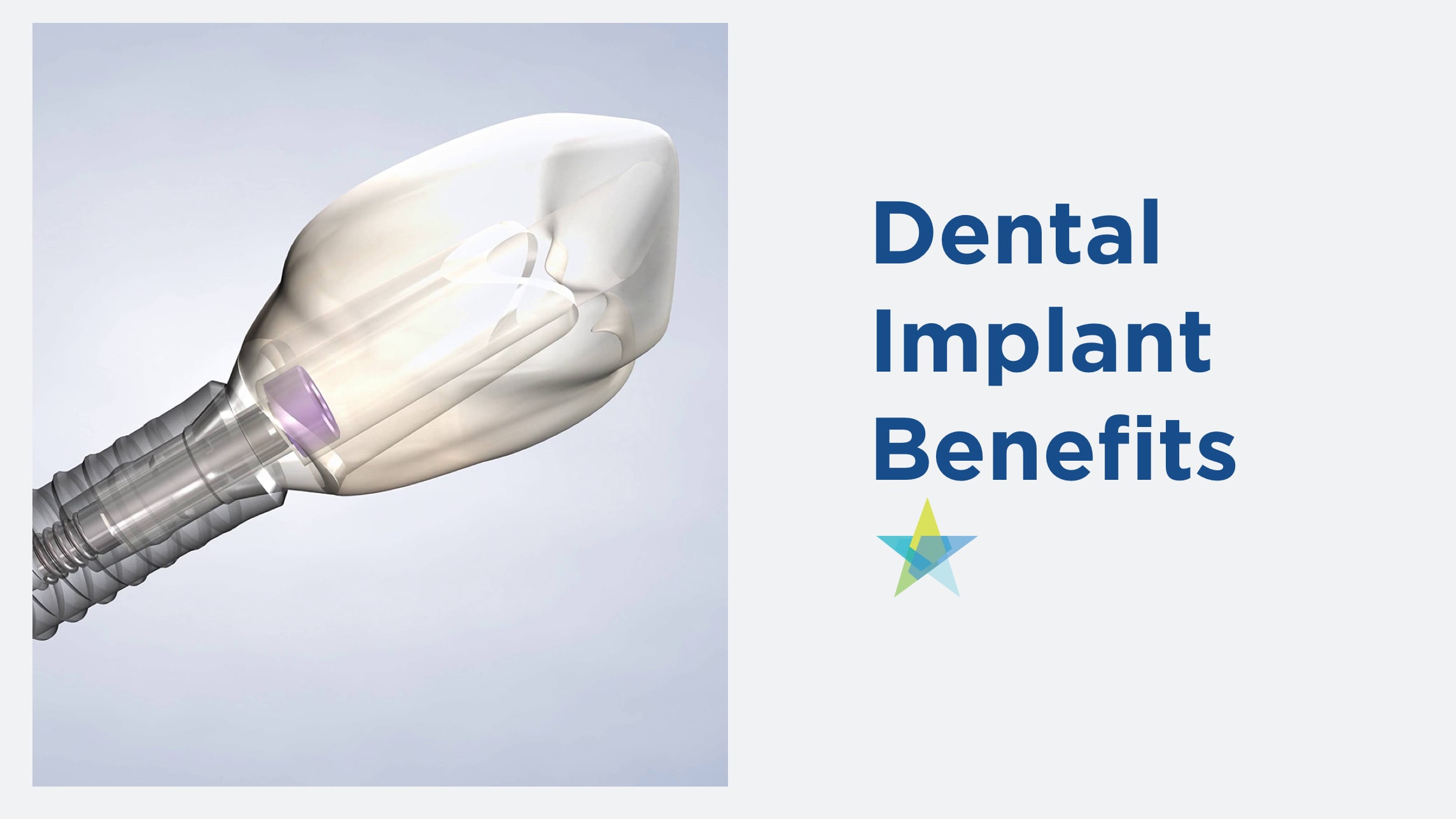 Dental implant benefits