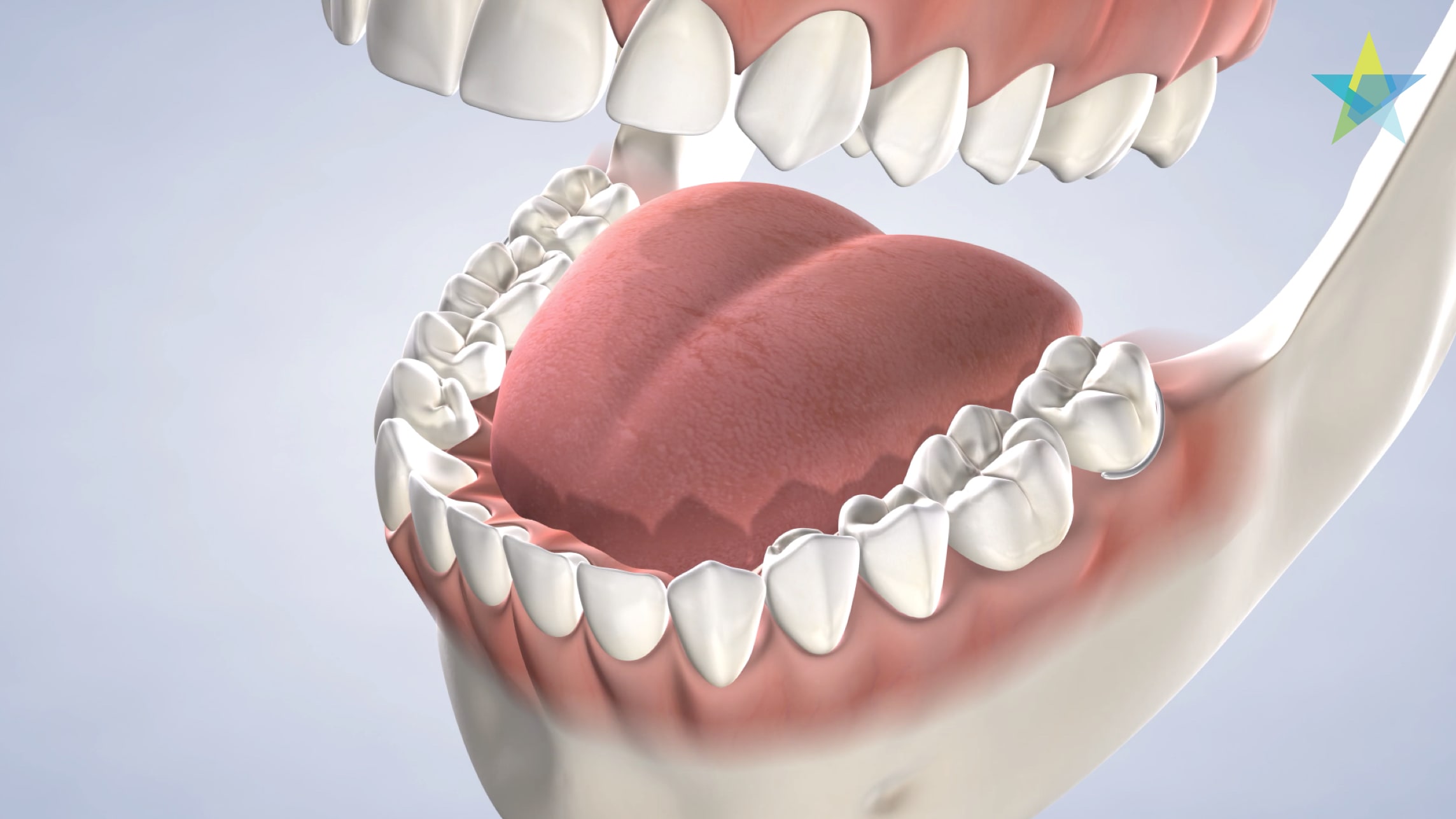 Procedure tooth replacement options