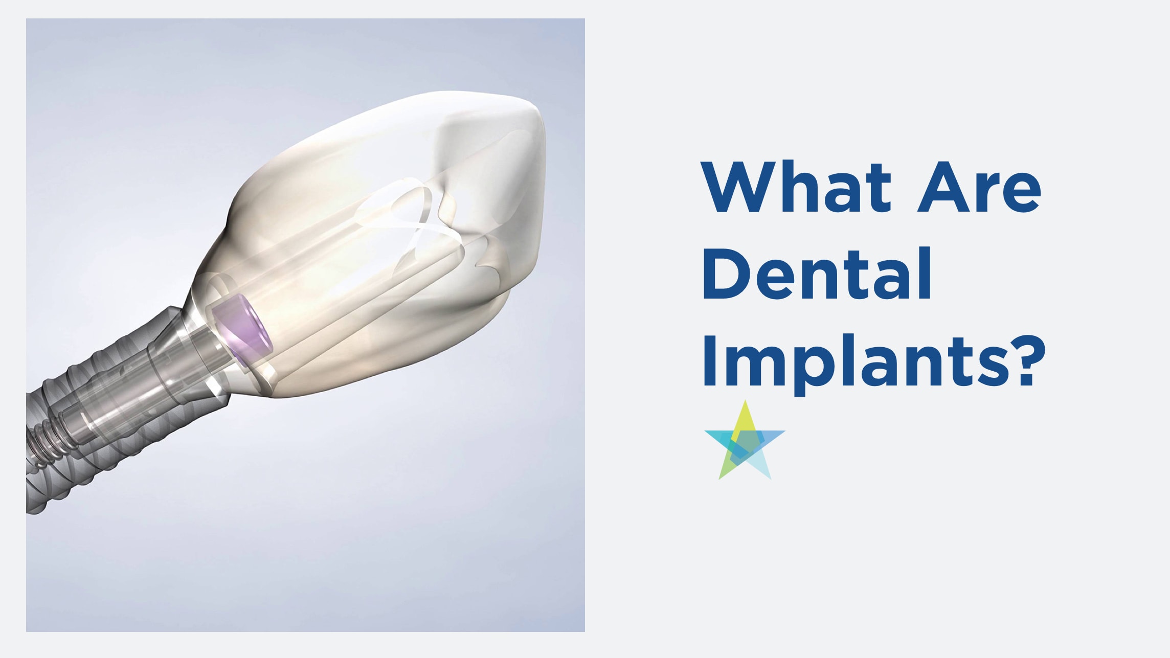 What are dental implants