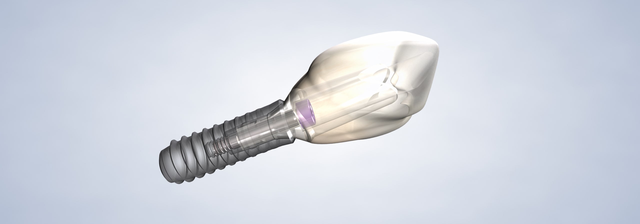 Procedure original hero desktop dental implants