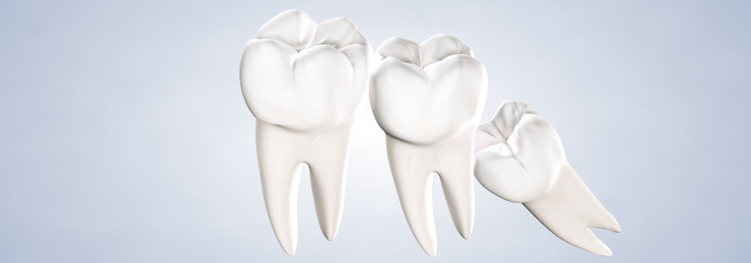Wisdom teeth removal procedure desktop