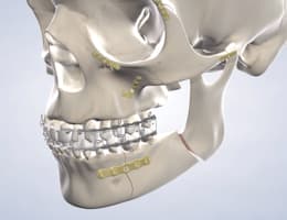 Facial trauma procedure thumb
