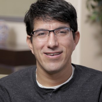 Rafael underwent SARPE treatment in Fresno, CA.
