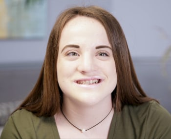 Nicole testimonial oral pathology facewall