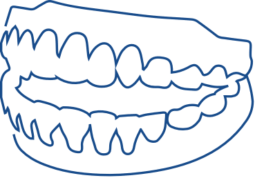 Pre prosthetic surgery