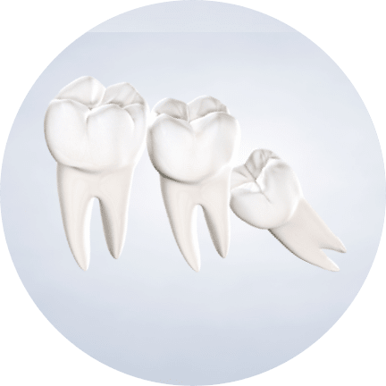 Homepage procedure wisdom teeth