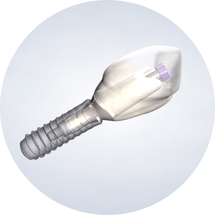 Homepage procedure dental implant