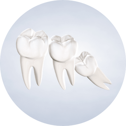 Homepage procedure wisdom teeth