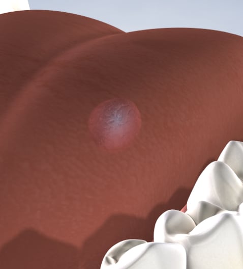 query  oral pathology