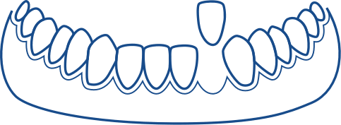 Tooth replacement options