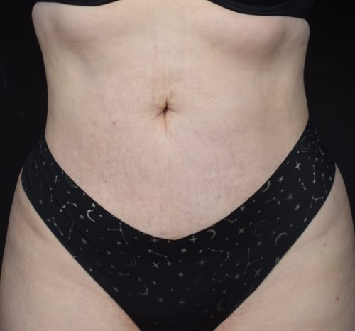 Query after patient 80