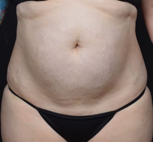 Query before patient 80