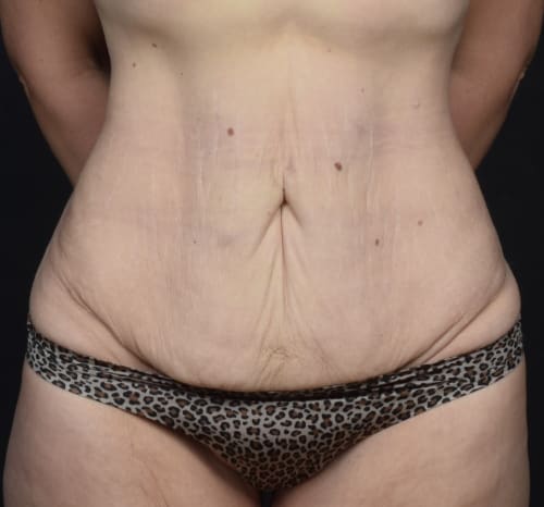 Query before patient 123