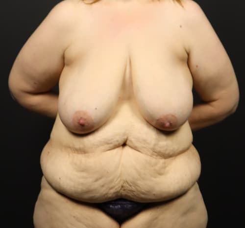 Query before patient 127