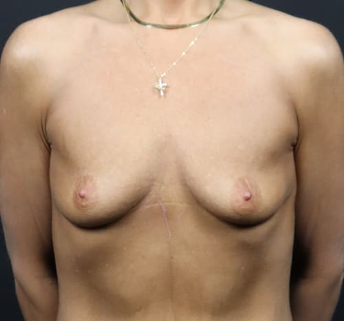 Query before patient 110