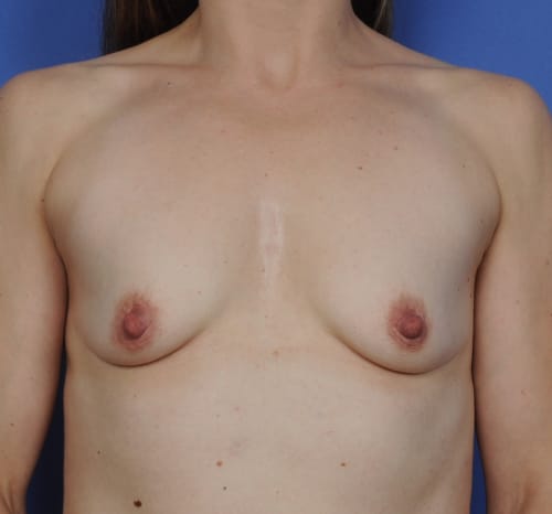 Query before patient 2