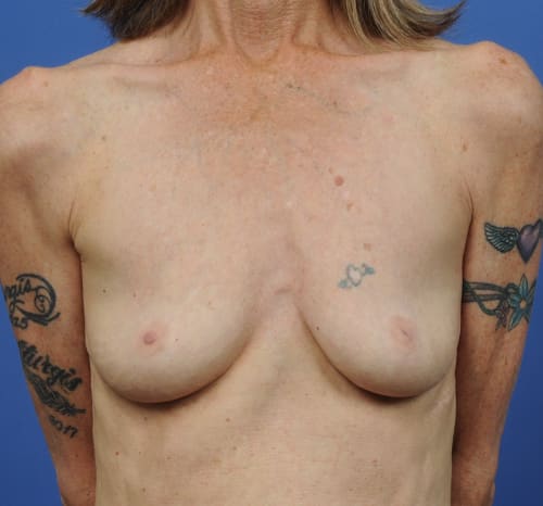 Query before patient 3