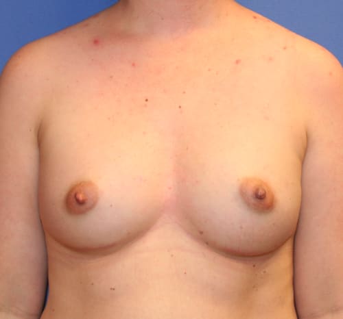 Query after patient 101