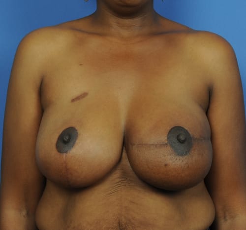 Query after patient 102