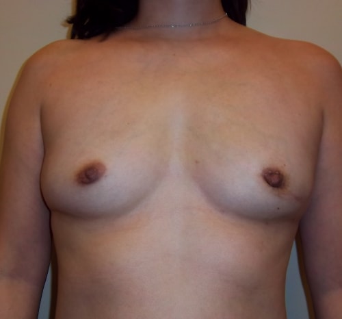 Query after patient 103