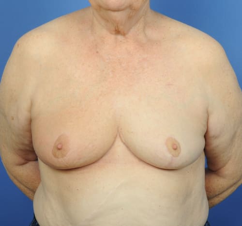 Query after patient 88