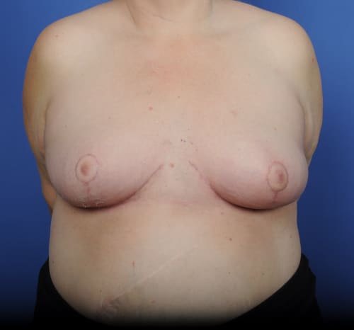 Query after patient 95