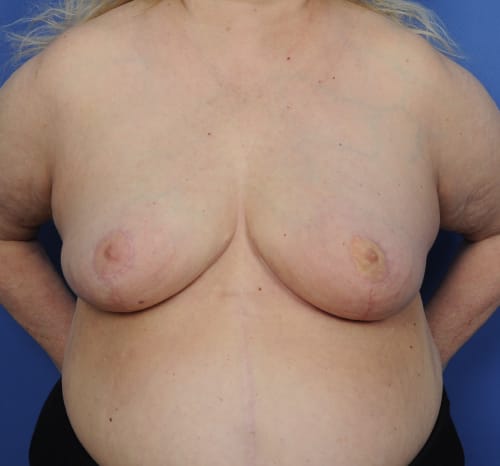 Query after patient 96