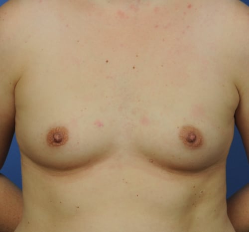 Query before patient 101