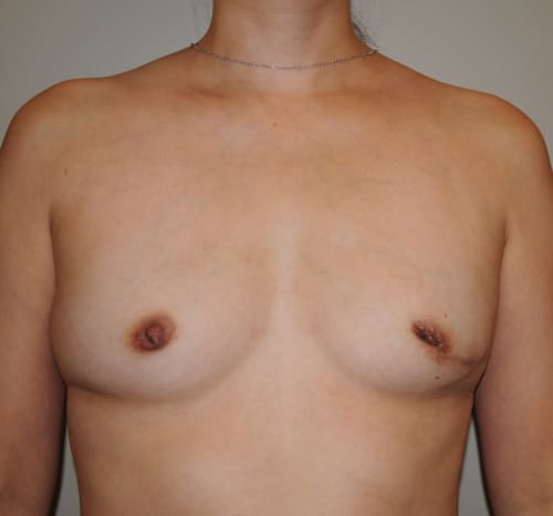 Query before patient 103