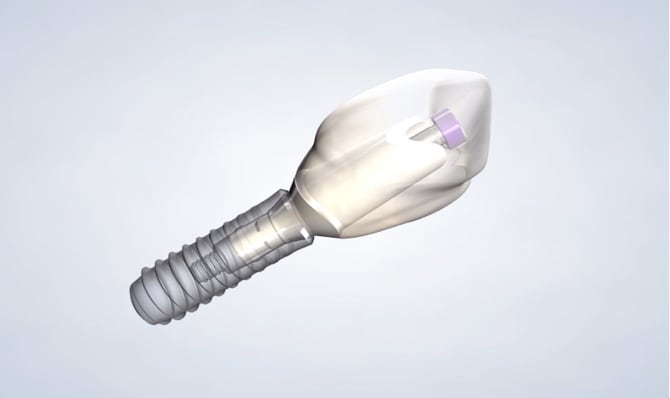 Dental implants in South Jordan, Provo, Payson, and Lehi, Utah