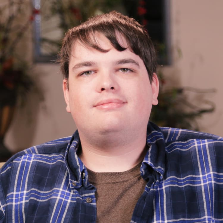 Michael had his wisdom teeth removed, Kingsburg, CA.