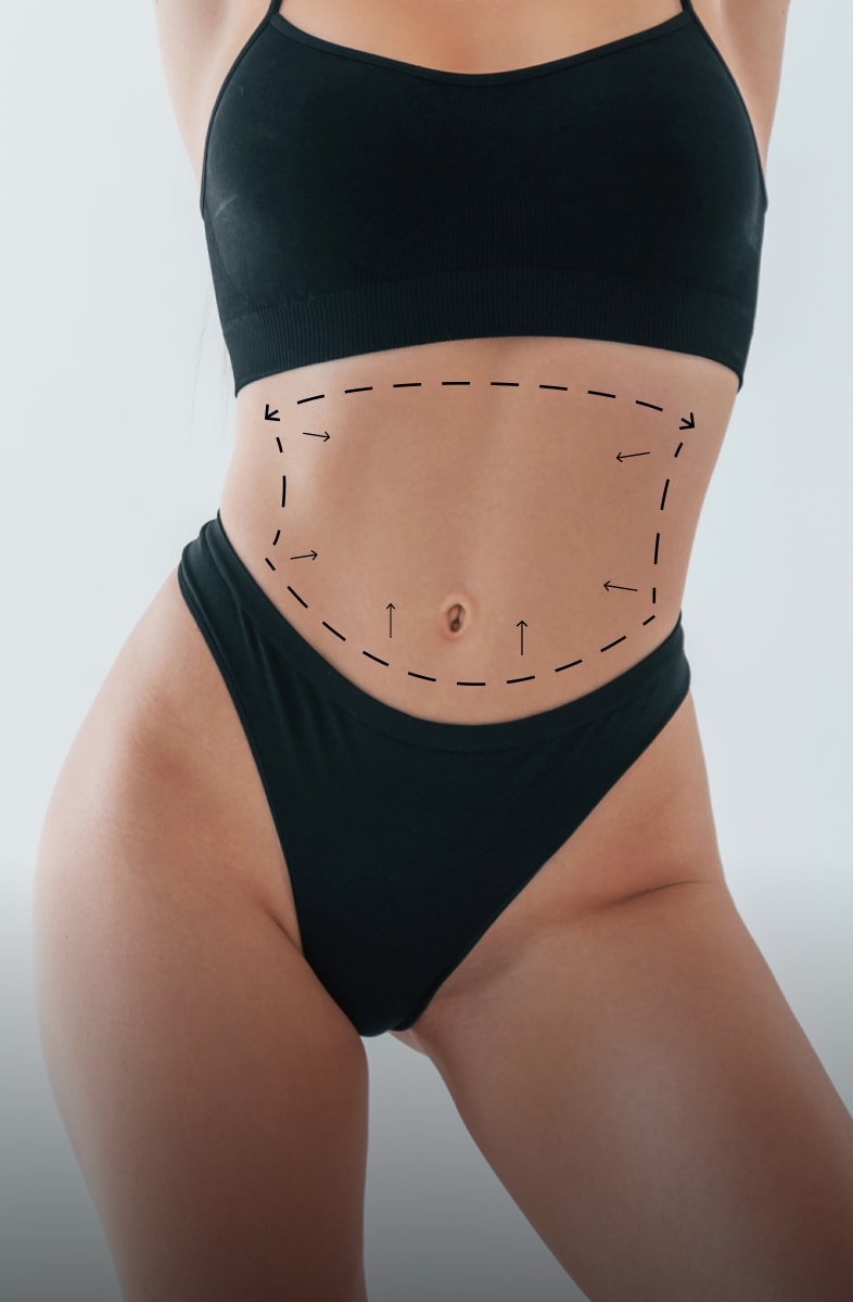 Liposuction banner mobile