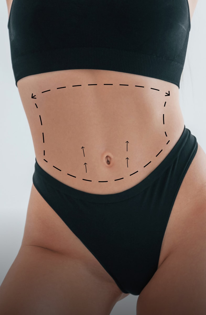 Tummy tuck banner mobile