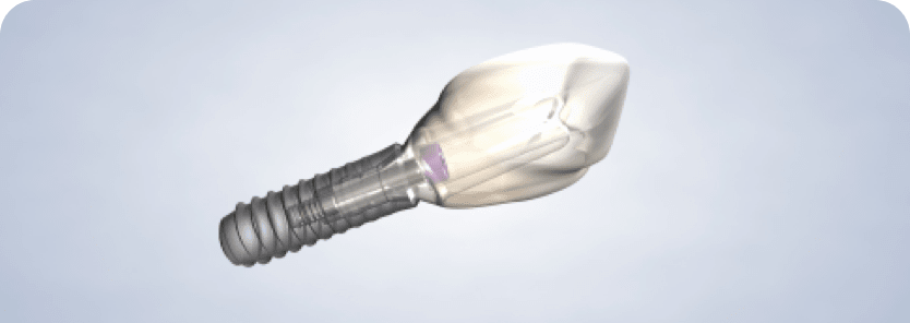 Dental implants query image