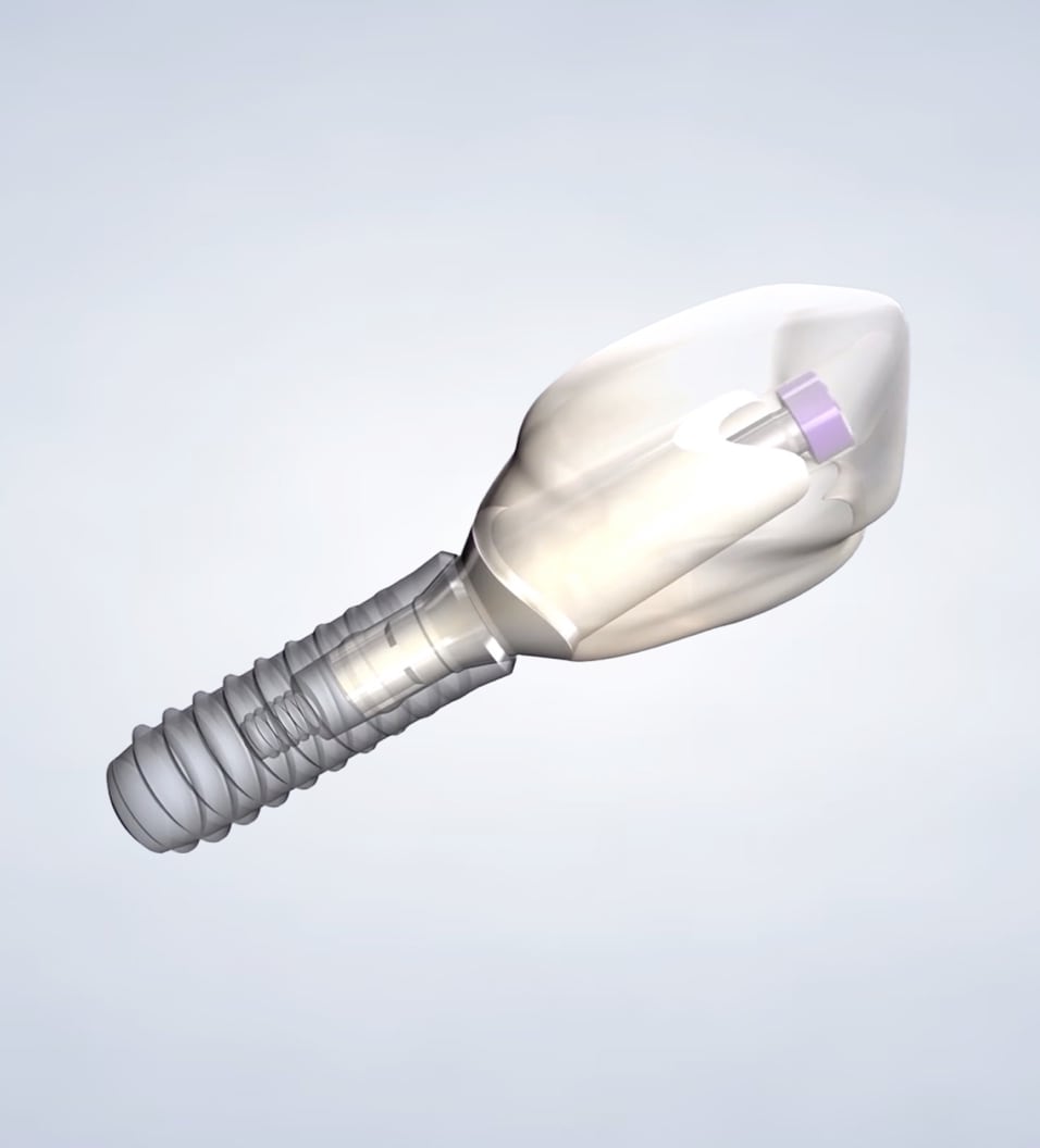 Location  dental implants