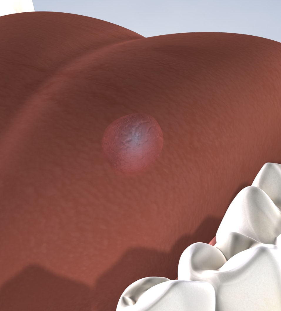 Oral pathology in Fresno, Clovis, Reedley, and Madera, CA