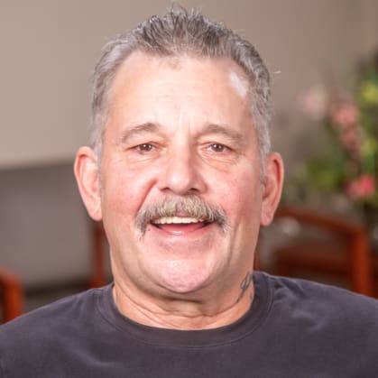 Michael had a tooth extraction in Middlesex, NJ