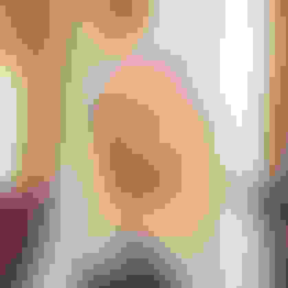 Cyndi di biopsy testimonial facewall