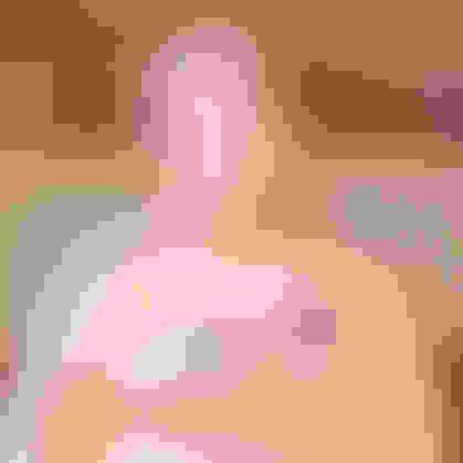 Dianne AO4 MaxillaImplant facewall