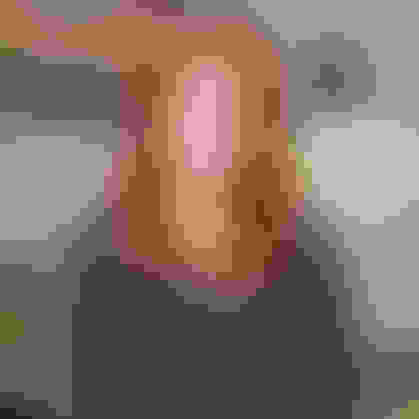 Melissa ext biopsy testimonial facewall