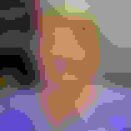 Brenda had oral surgery at Oral Surgery Group