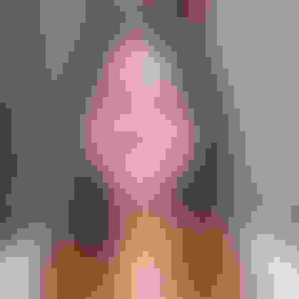 Brooke had oral surgery at Oral Surgery Group